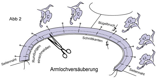 Armloch